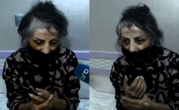 Zöhrə Abdullayeva xəstəxanaya yerləşdirilib