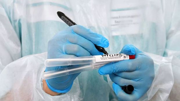 Ötən gün 6 minə yaxın test aparılıb