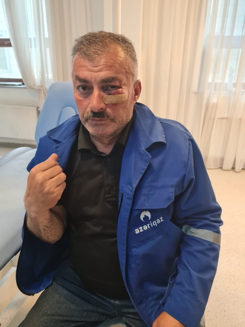“Azəriqaz”ın əməkdaşı döyüldü - Yaba ilə...