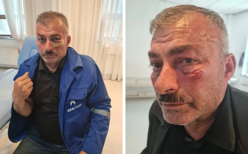 “Azəriqaz”ın əməkdaşına qarşı zor tətbiqi ilə bağlı cinayət işi başlanıb