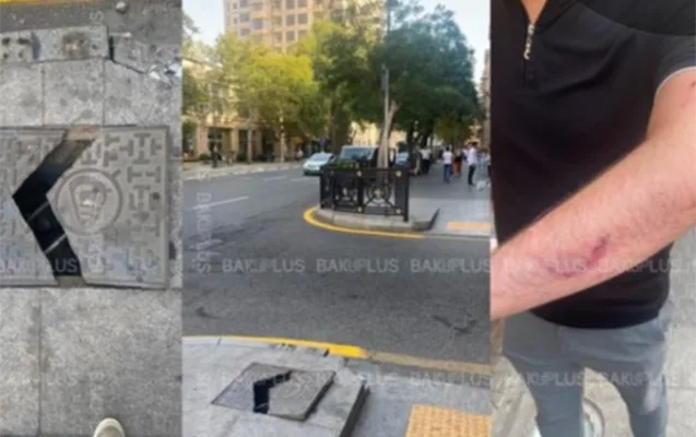Bakıya istirahətə gəlmişdi, quyuya düşüb yaralandı - AÇIQLAMA