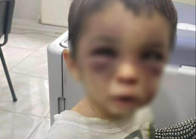 Birlikdə yaşadığı şəxs 2 yaşlı oğlunu ölümcül şəkildə döydü