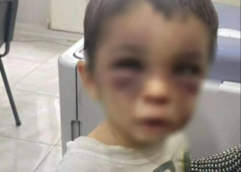 Birlikdə yaşadığı şəxs 2 yaşlı oğlunu ölümcül şəkildə döydü