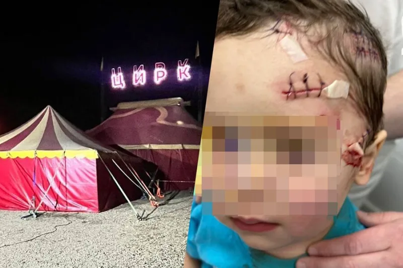 Sirkdə panter uşağa hücum etdi: Vəziyyəti orta ağırdır