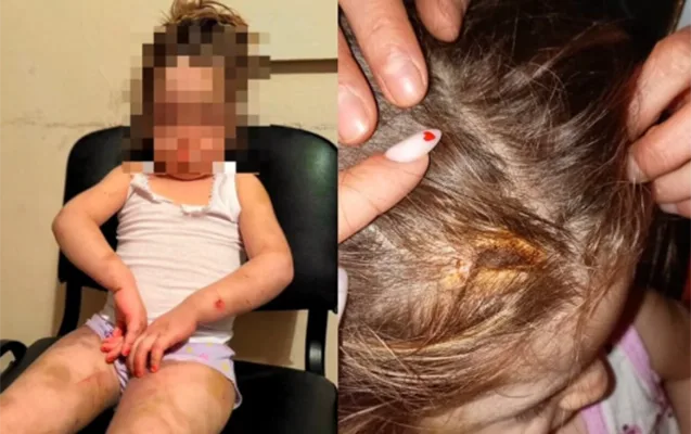 Azyaşlı ona işgəncə verən anasından alındı - FOTO - VİDEO