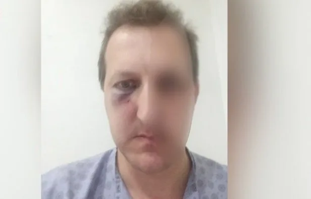 Xalq artistinin oğlunun döyülməsinə görə daha 2 şəxs SAXLANILDI