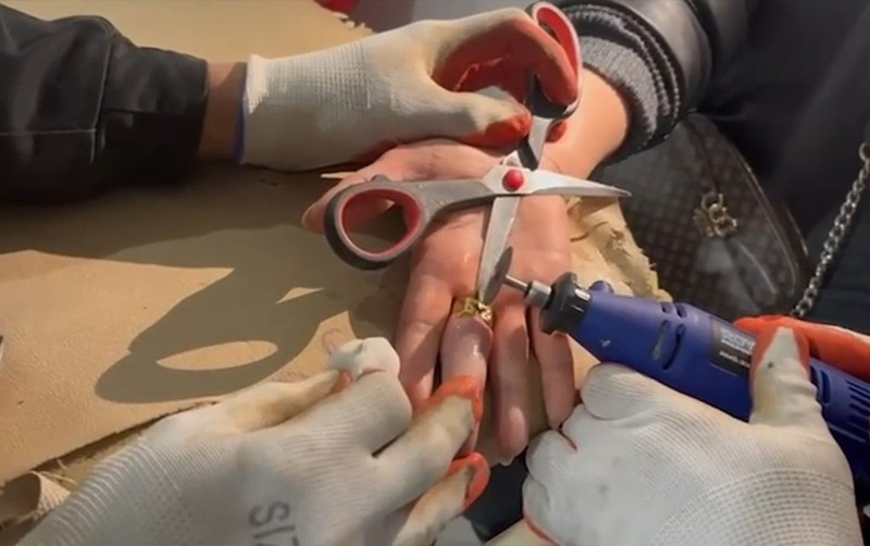 Barmağında üzük sıxışdı: FHN-ni çağırdılar - VİDEO