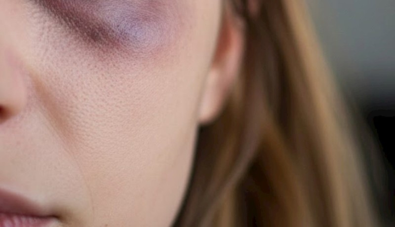 Bakıda aktyorun anası döyüldü - TƏFƏRRÜAT