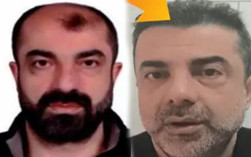 Estetik əməliyyatlarla 7 il gizlənə bildi - Foto