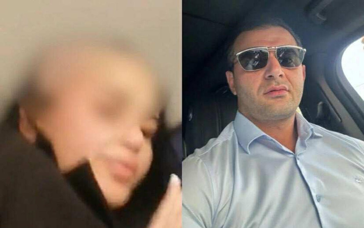 Arvadının saçını keçəl edən şəxsə hökm oxundu