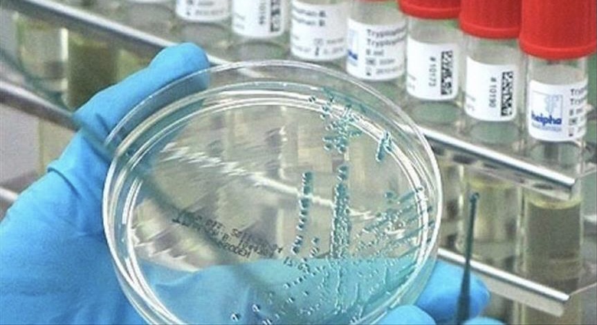 ABŞ-da hantavirus təhlükəsi artır