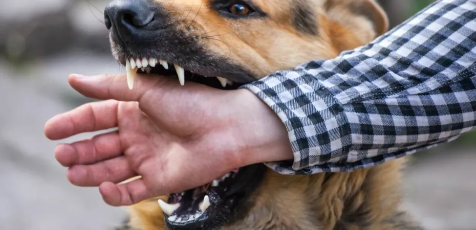 Həkim: Heyvan dişləməsindən sonra...