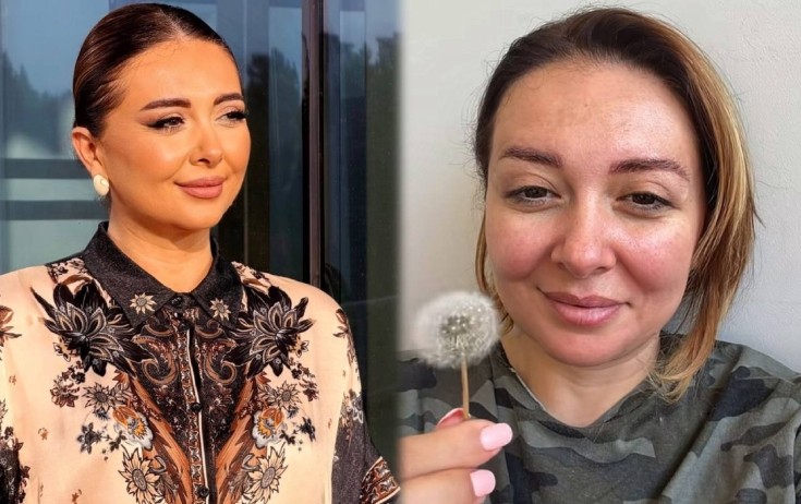 Lalə Azərtaş makiyajsız görüntüsünü paylaşdı