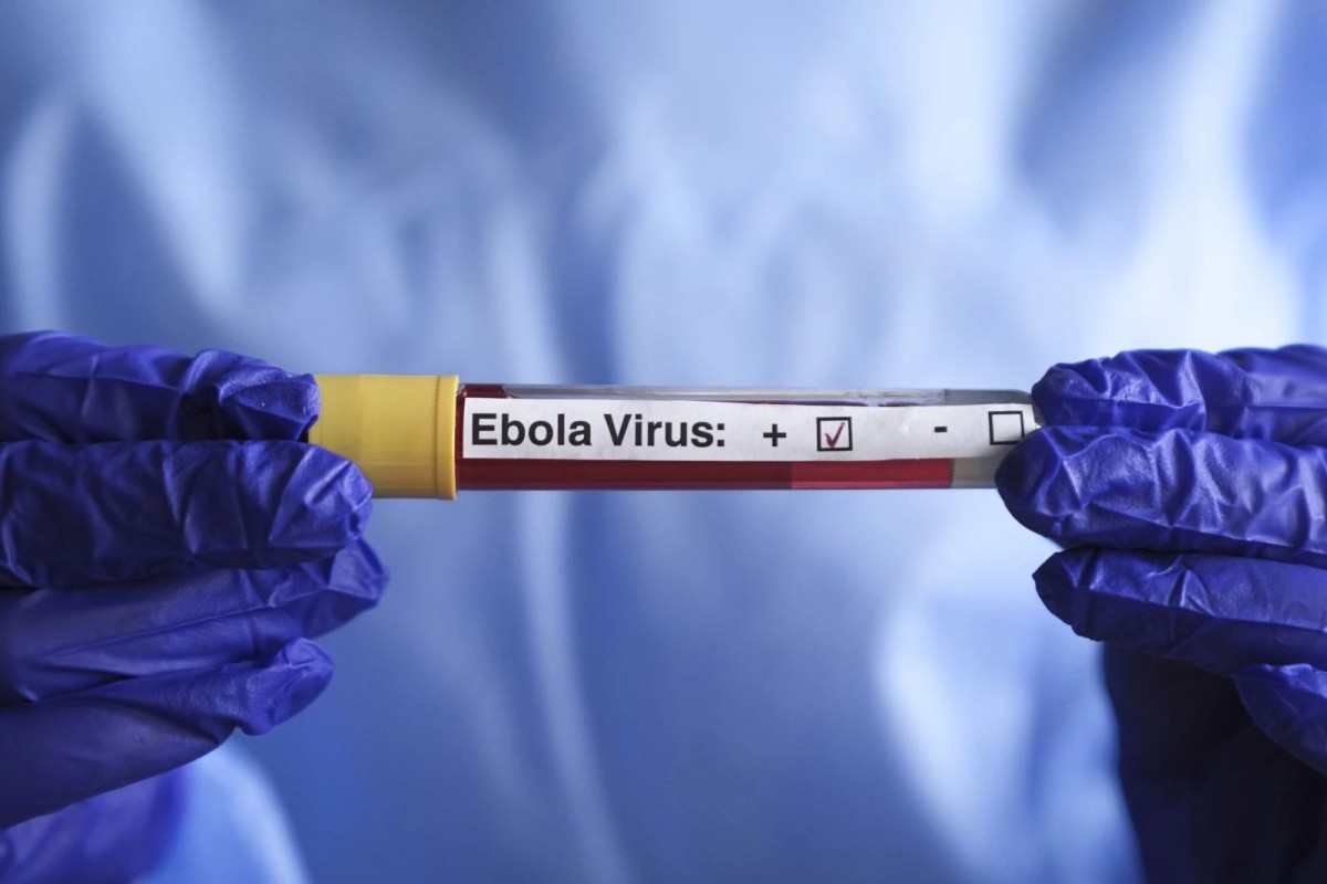 Ebola sürətlə yayılır: Ölənləri sayı 2000-i ötdü