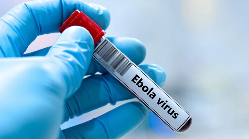 ÜST: Afrikada Ebola epidemiyası artıb