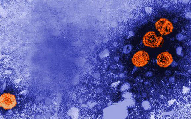 Hepatitlə bağlı diqqətçəkən statistika: Ötən illə müqayisədə azalma var